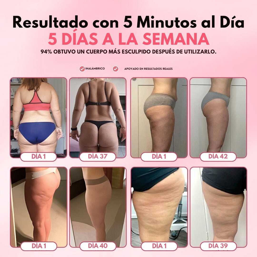 Masajeador Anticelulitis Eléctrico