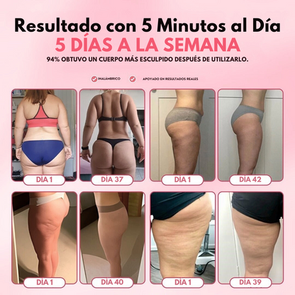 Masajeador Anticelulitis Eléctrico